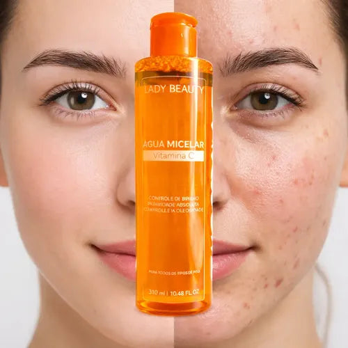 Água Micelar Facial Com Vitamina C Lady Beauty 310ml