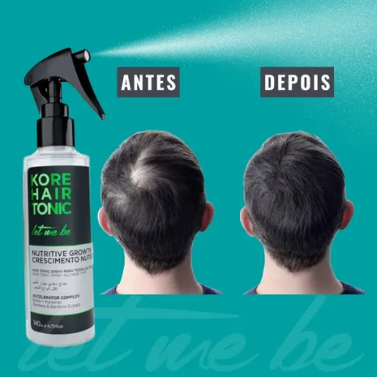 Spray Tônico crescimento Kore Hair Let me be 140ml